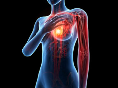 cardiovascular disease, genes