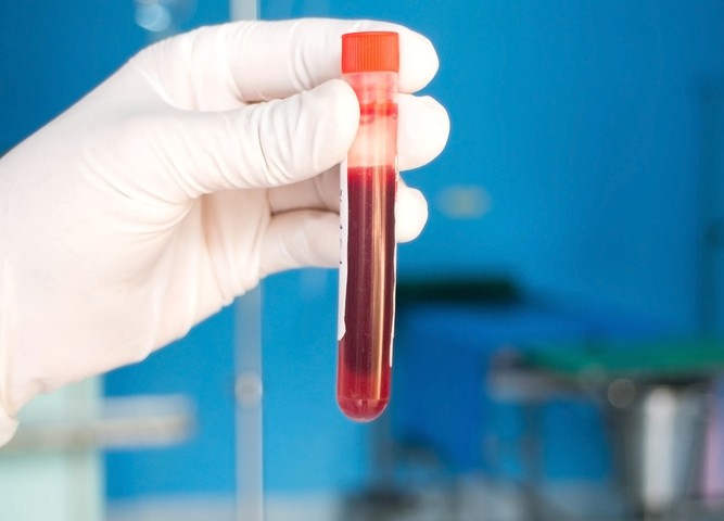 Partnership Yields Alzheimer’s Diagnostic Breakthrough at 2 Canadian Universities Partnership Yields Alzheimer’s Diagnostic Breakthrough at 2 Canadian Universities