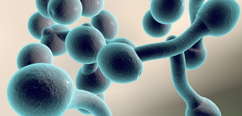 Fungal Infection as a Risk Factor in Alzheimer’s Disease Fungal Infection as a Risk Factor in Alzheimer’s Disease
