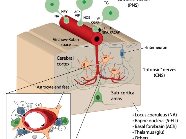 Amyloid Plaques Found To Build Up Around Brain’s Blood Vessels Involved in Alzheimer’s Disease Amyloid Plaques Found To Build Up Around Brain’s Blood Vessels Involved in Alzheimer’s Disease