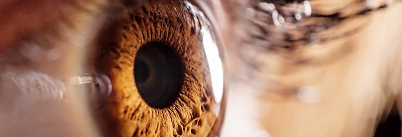 MicroRNA a Potential Therapeutic Target for Alzheimer’s and Age-Related Macular Degeneration MicroRNA a Potential Therapeutic Target for Alzheimer’s and Age-Related Macular Degeneration