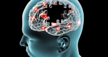 potential Alzheimer's treatment