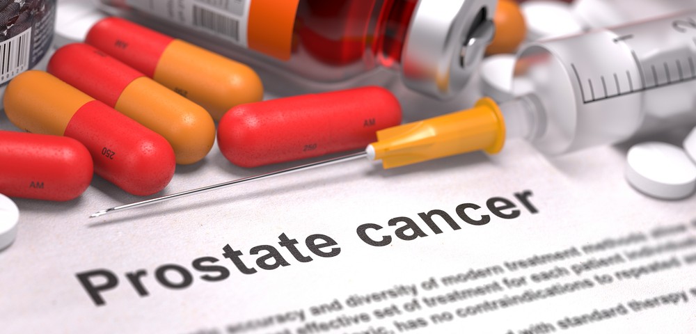 Alzheimer’s Risk Linked to Prostate Cancer Therapy in Study Alzheimer’s Risk Linked to Prostate Cancer Therapy in Study