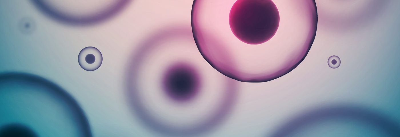 New Alzheimer’s Drug Shows Positive Dose-Response in Phase 2 Trial New Alzheimer’s Drug Shows Positive Dose-Response in Phase 2 Trial