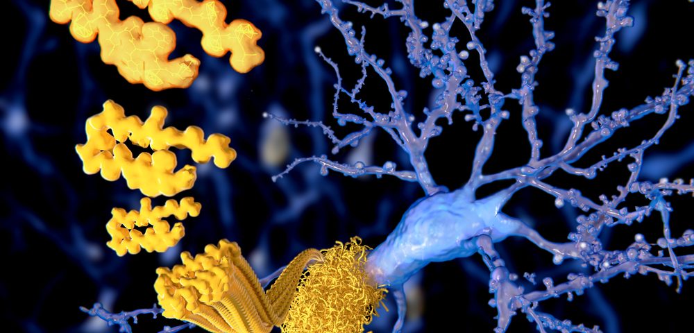 vTv Therapeutics Enrolling People with Mild Alzheimer’s for Phase 3 Study of Oral Therapy vTv Therapeutics Enrolling People with Mild Alzheimer’s for Phase 3 Study of Oral Therapy