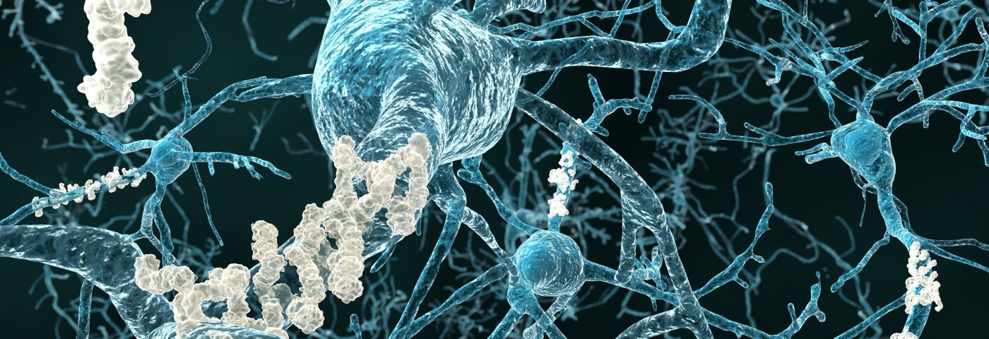 Neurotrope Concludes Patient Dosing, Monitoring in Clinical Trial of Bryostatin-1 for Alzheimer’s Neurotrope Concludes Patient Dosing, Monitoring in Clinical Trial of Bryostatin-1 for Alzheimer’s
