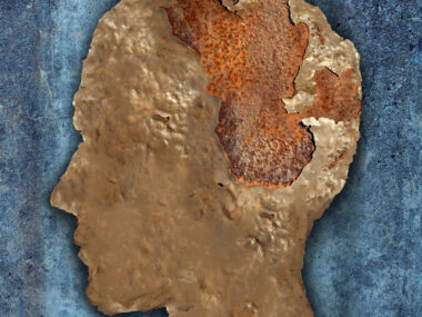 aging brains and disease