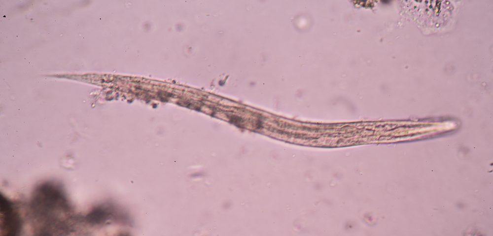 Roundworms May Be Used to Screen Substances in Battle Against Alzheimer’s Roundworms May Be Used to Screen Substances in Battle Against Alzheimer’s