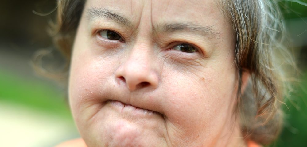 Good Clinical Practices Important to Treat Alzheimer’s in People With Down Syndrome Good Clinical Practices Important to Treat Alzheimer’s in People With Down Syndrome