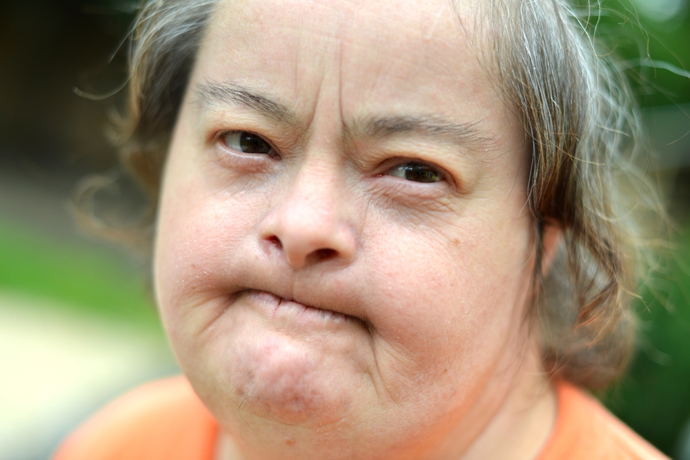 An older woman with Down syndrome.