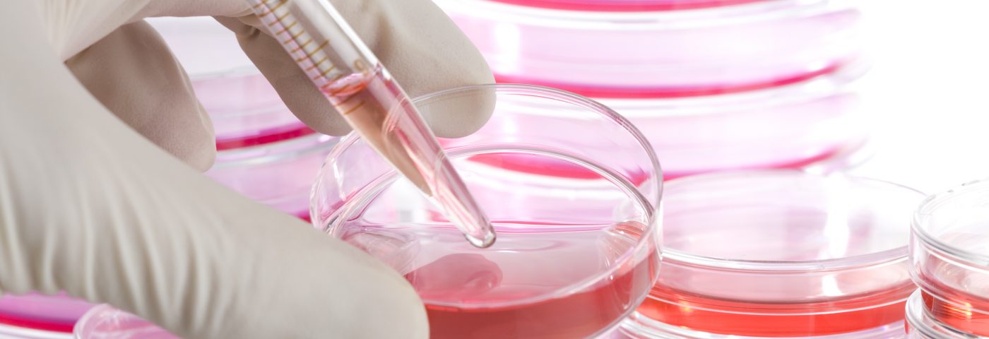 NIH Awards Recombinetics a Research Grant to Develop Swine Model of Alzheimer’s NIH Awards Recombinetics a Research Grant to Develop Swine Model of Alzheimer’s