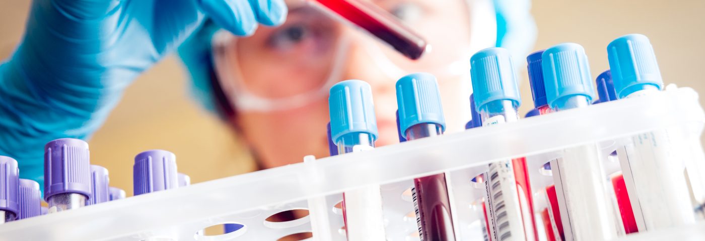 Bluefield Project to Cure Frontotemporal Dementia Gets $1.2M to Advance FTD Blood Testing Bluefield Project to Cure Frontotemporal Dementia Gets $1.2M to Advance FTD Blood Testing