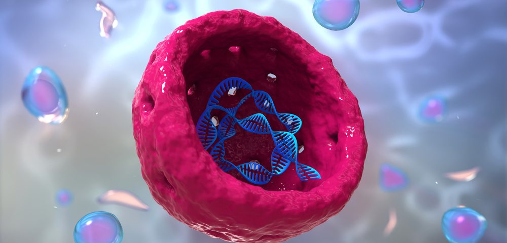 Researchers Identify Final Step Killing Damaged Neurons in Self-destructive Process Researchers Identify Final Step Killing Damaged Neurons in Self-destructive Process