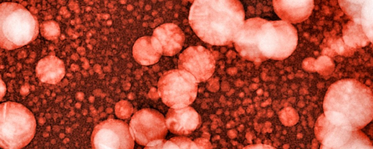 Ultrasound and Gas Bubbles May One Day Deliver Alzheimer’s Treatments Directly to Brain Ultrasound and Gas Bubbles May One Day Deliver Alzheimer’s Treatments Directly to Brain