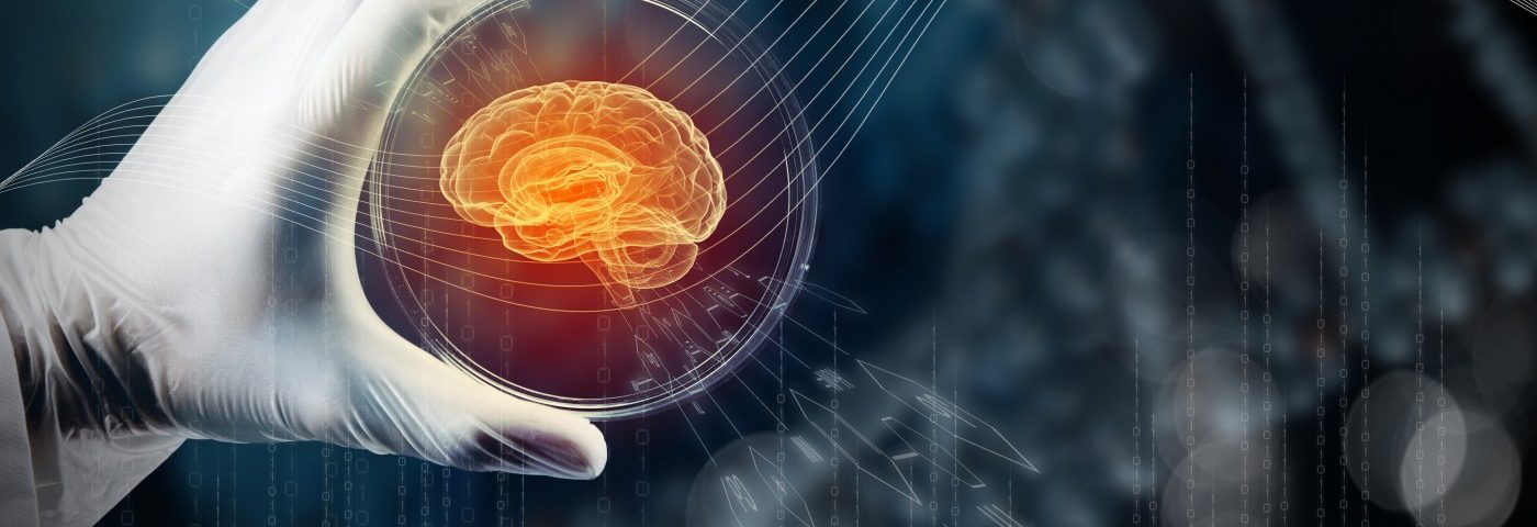 ProMIS Biotech Hopes to Prove Amyloid Theory in Alzheimer’s with New Targeted Therapies ProMIS Biotech Hopes to Prove Amyloid Theory in Alzheimer’s with New Targeted Therapies