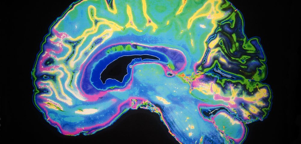 Neuronascent Granted Third US Patent for Potential Methods to Treat Alzheimer’s, Other Disorders Neuronascent Granted Third US Patent for Potential Methods to Treat Alzheimer’s, Other Disorders