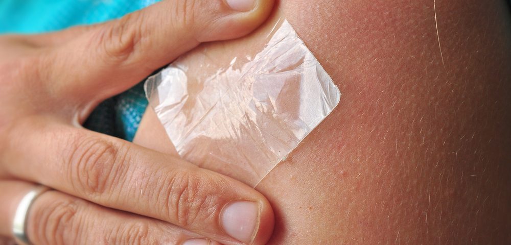 Phase 1 Study Testing Skin Patch Option for Alzheimer’s Patients Using Aricept Phase 1 Study Testing Skin Patch Option for Alzheimer’s Patients Using Aricept