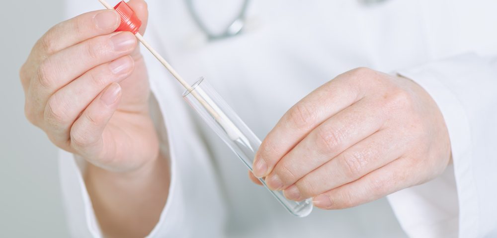 Can a Cheek Swab Be Used to Diagnose Alzheimer’s? 3D Clinical Trial Suggests it Can Can a Cheek Swab Be Used to Diagnose Alzheimer’s? 3D Clinical Trial Suggests it Can