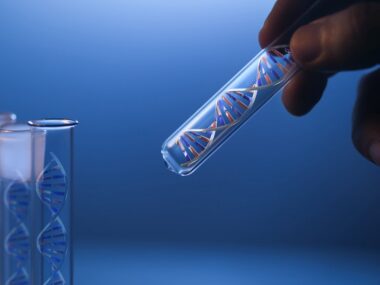 Alzheimer's genetic risk test