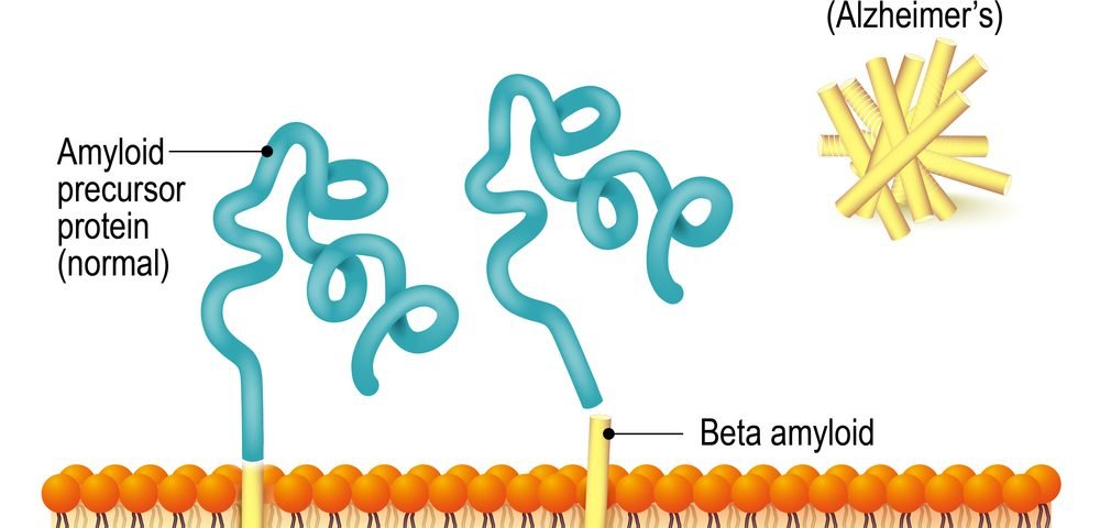 ALZ-801 Works Against Alzheimer’s by Preventing Protein Component Clumping, Study Reports ALZ-801 Works Against Alzheimer’s by Preventing Protein Component Clumping, Study Reports