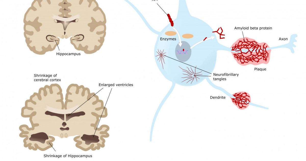 超貴重CD DNA「Scatter the brain」 shutterstock_256201054-