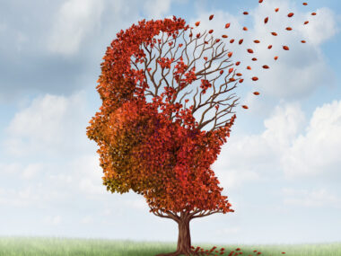 cholinesterase inhibitors