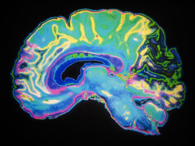 Alzheimer's synapses study