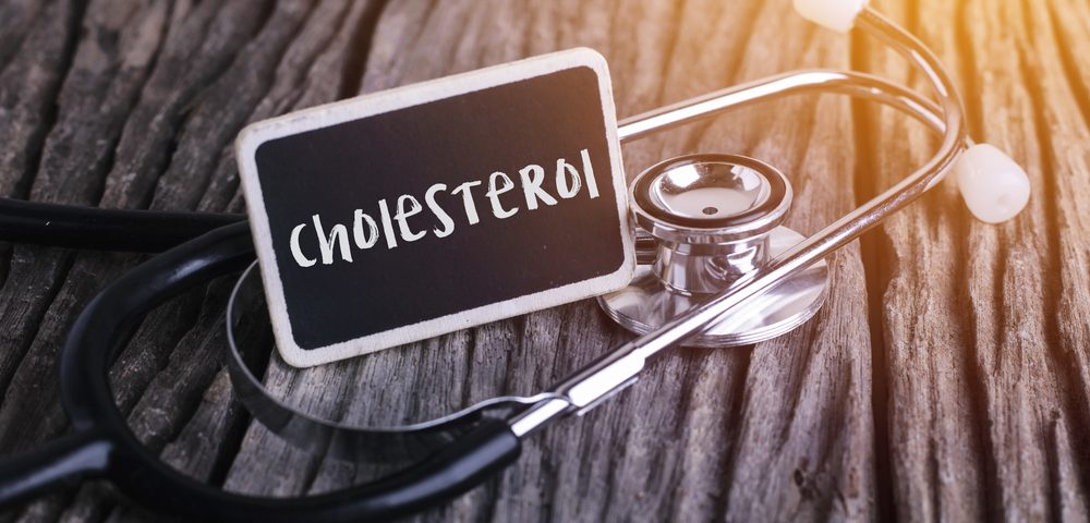 CTD and Kerwin Center Discussing Partnership on Cholesterol-Lowering Therapies for Alzheimer’s CTD and Kerwin Center Discussing Partnership on Cholesterol-Lowering Therapies for Alzheimer’s