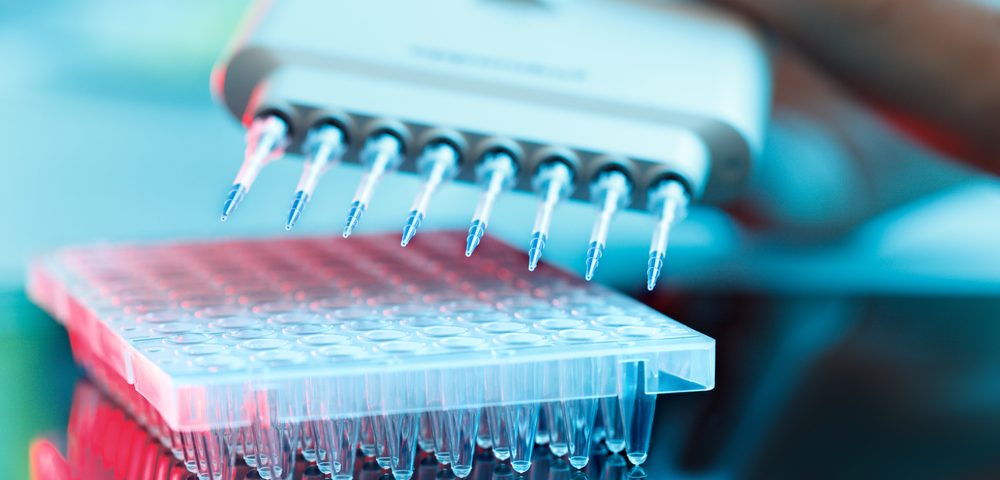 Alzheimer’s Researchers Identify Biomarkers of Response to Anavex 2-73 Treatment Alzheimer’s Researchers Identify Biomarkers of Response to Anavex 2-73 Treatment