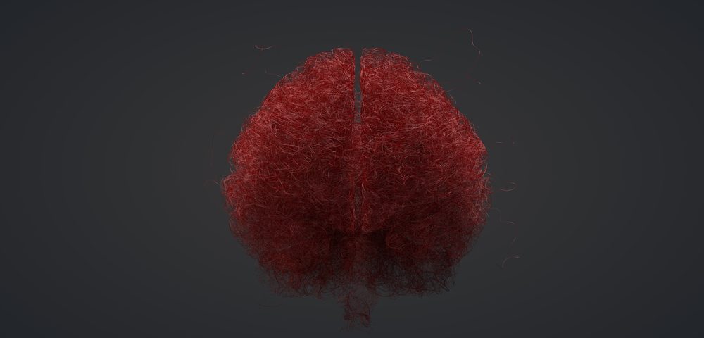 USC Joins Consortium to Look for Blood-vessel-related Biomarkers of Alzheimer’s USC Joins Consortium to Look for Blood-vessel-related Biomarkers of Alzheimer’s