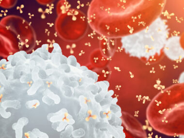 vascular disease and dementia