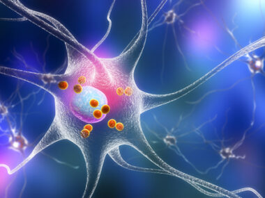 amyloid clumping