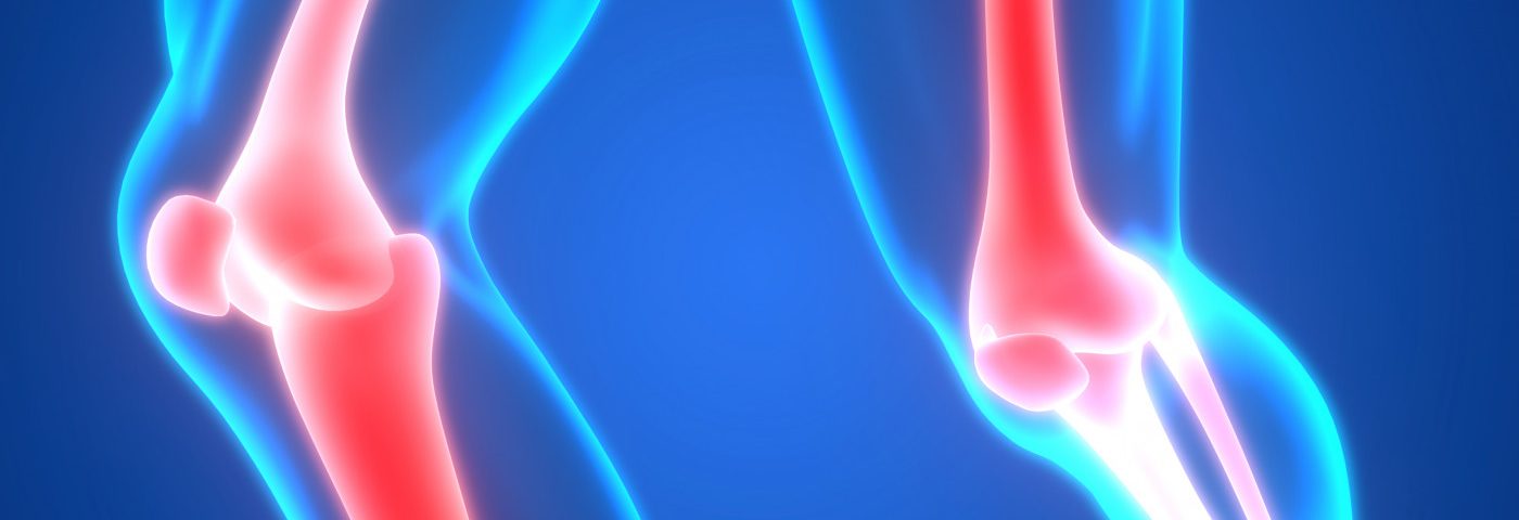 Long-term Treatment with Thiazide Diuretics May Lower Risk of Bone, Hip Fractures, Study Suggests Long-term Treatment with Thiazide Diuretics May Lower Risk of Bone, Hip Fractures, Study Suggests