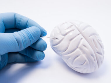 amyloid-beta study