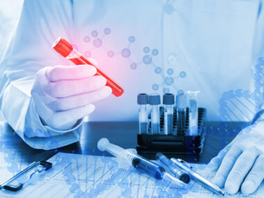 LymPro PET 2 clinical trial