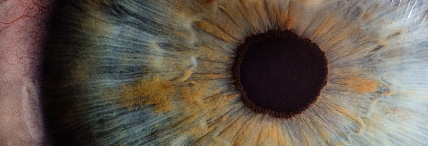 UW Scientist Awarded $17.2M Grant to Study Link Between Eye Health and Alzheimer’s UW Scientist Awarded $17.2M Grant to Study Link Between Eye Health and Alzheimer’s