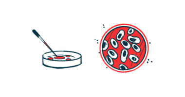 toxic amyloid beta | Alzheimer's News Today | Illustration of cells in petri dish