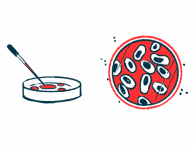 toxic amyloid beta | Alzheimer's News Today | Illustration of cells in petri dish