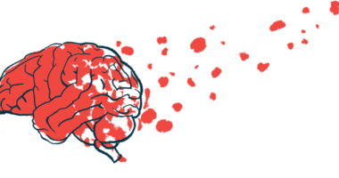 A brain is shown with bits breaking away, floating into the air, suggesting brain damage.