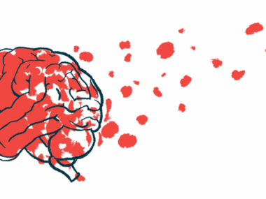 A brain is shown with bits breaking away, floating into the air, suggesting brain damage.