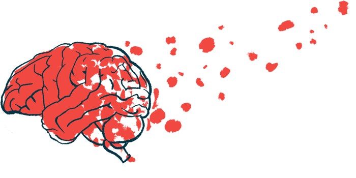 A brain is shown with bits breaking away, floating into the air, suggesting brain damage.