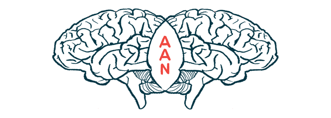Aduhelm real-world trial | Alzheimer's News Today | AAN brains illustration