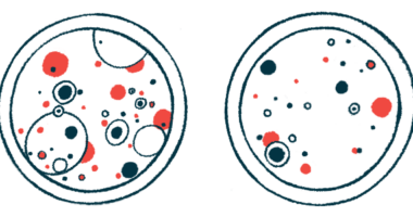 amyloid beta protein and Alzheimer's disease | Alzheimer's News Today | illustration of cells in petri dishes