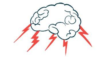 Bolts of lightning are pictured shooting out of a human brain.