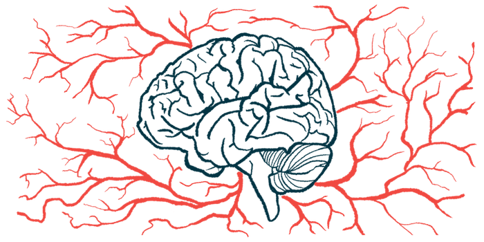 An illustration of a brain is shown, with vessels surrounding it.