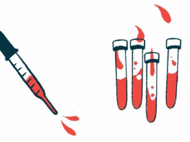 A dropper and four vials containing red liquid are shown.