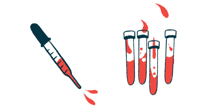 A dropper and four vials containing red liquid are shown.